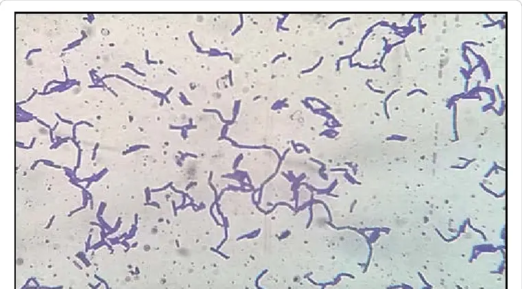 Lactobacillus plantarum